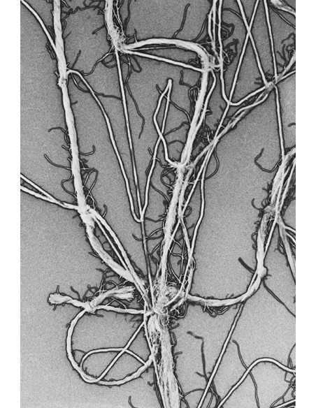 Enough Rope 1 Donnez-lui assez de corde et il ira se pendre - solar...