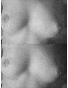 No title (breasts) 2 photographs of a bare female breast published ...
