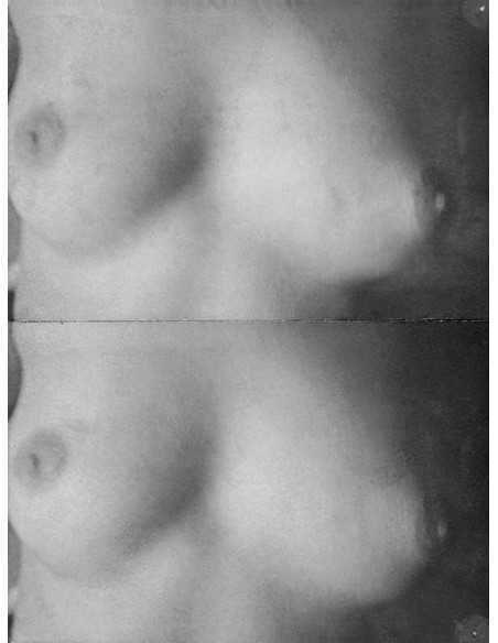 Sans titre (seins) 2 photographies d'une poitrine féminine nue publ...