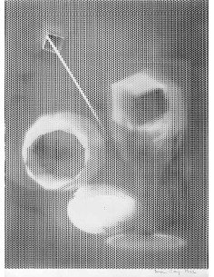 Rayography frame two cylindric shapes around a pixelized stem publi...